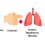 The Mounting Burden of Non-Communicable Diseases in the Savannah Belt of Ghana and its Implication on Livelihoods